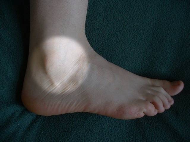 File:Ankle highlighted.png